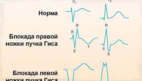 Влияние отклонения на приемку металлопроката