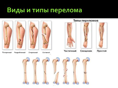 Холодное растяжение