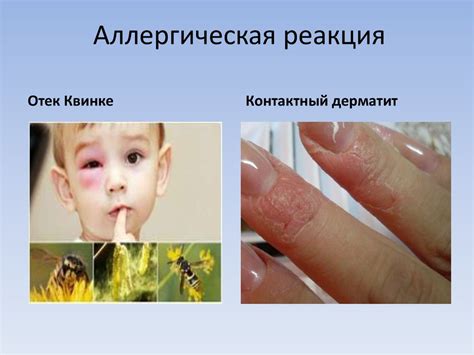Аллергические реакции на красители