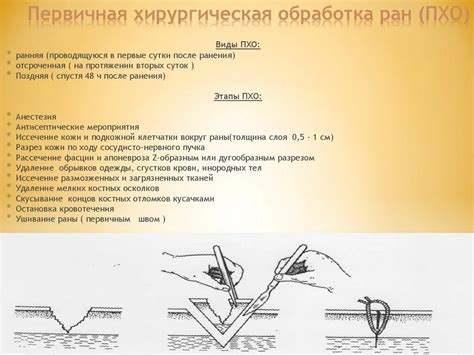 Альтернативные материалы для обработки раны с минимальным риском заражения