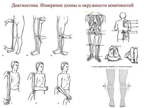 Альтернативные подходы к изменению длины нижних конечностей: преимущества и недостатки