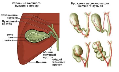 Боли в области желчного пузыря и печени