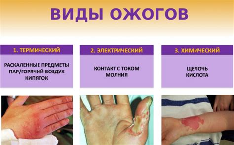 Важность обращения к специалистам для предотвращения ожогов и повреждений