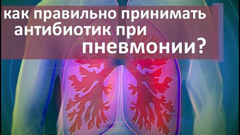 Важные рекомендации врачей при применении Левинокса для лечения пневмонии