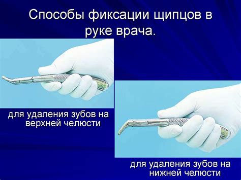 Важные этапы удаления ненужных модификаций