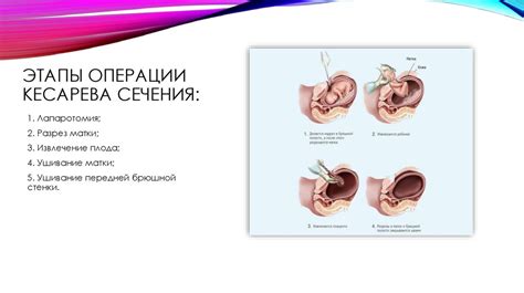 Взаимосвязь между тепловым режимом организма и возможностью проведения операции кесарева сечения