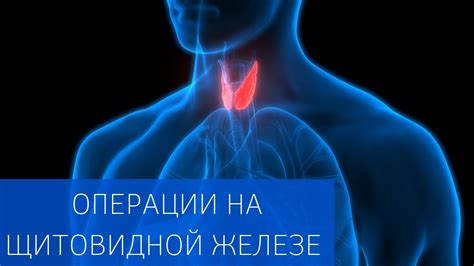 Виды операций на щитовидной железе: открытая и эндоскопическая