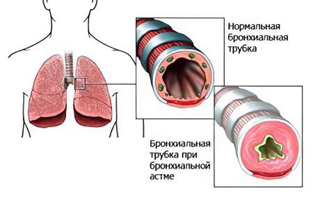 Влияет ли астма на работу машиниста