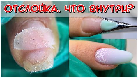 Влияние гель лака на здоровье ногтей