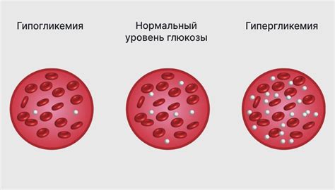 Влияние используемого соуса из сои на уровень глюкозы в крови