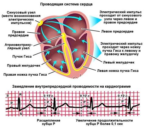 Влияние нарушений проводимости на сердечную работу