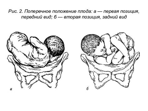 Влияние освещения на состояние сна и активности плода в материнской матке