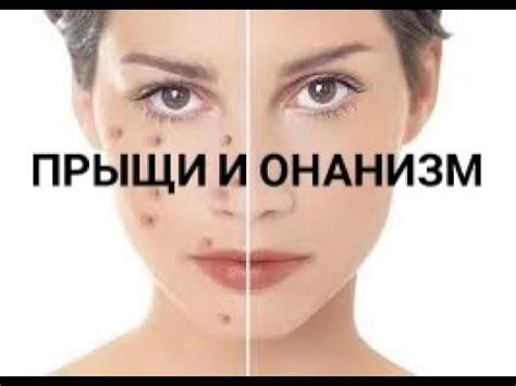 Влияние пара на прыщи