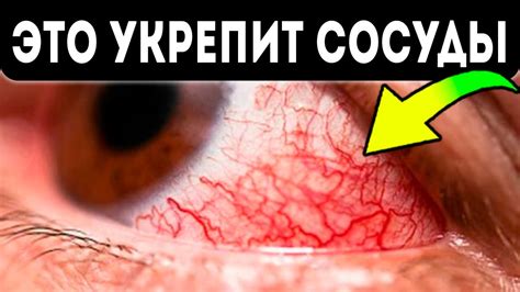 Влияние сосудов на здоровье глаз