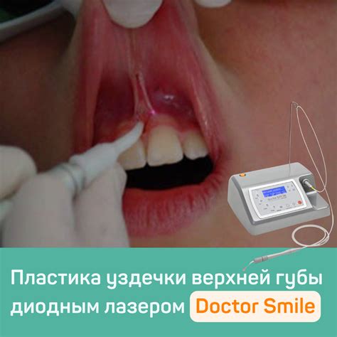 Влияние травматического воздействия на процесс заживления у уздечки