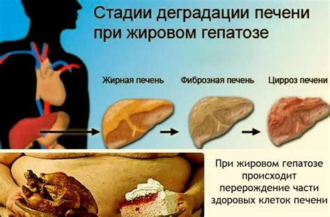Влияние тюбажа на жировой гепатоз и причины его эффективности