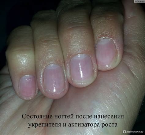Влияние увлажняющей жидкости на состояние ногтей после удаления покрытия