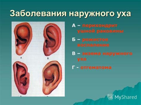 Воздействие продувания ушной раковины на воспалительные процессы в полости среднего уха
