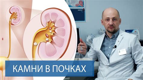 Возможна ли слабость в клинической картине мочекаменной болезни