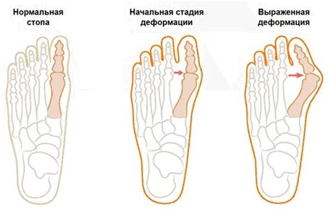 Возможные заболевания стопы