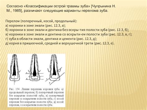 Возможные инфекции в зоне коронки