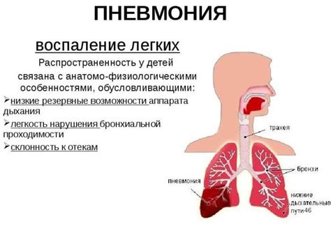 Возможные осложнения при пневмонии и двигательной активности