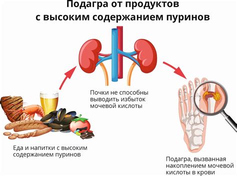 Возможные причины появления «ксерозом» у «тонких» дам