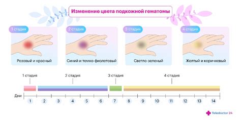 Возможные причины появления синяков на позвоночнике