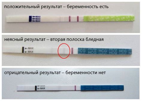 Возможные трудности при беременности при обнаружении 2 неточных полосок на тесте