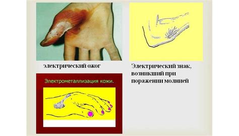 Вред запросов от электрического явления на людской организм