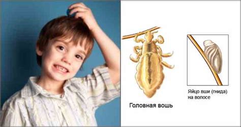 Вред от снов вши
