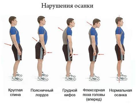 Вред прогиба в поясничном отделе
