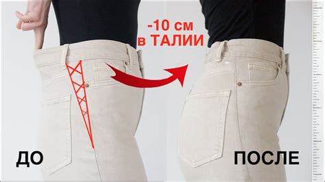 Выбор метода ушивки