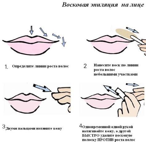 Выполнение процедуры удаления волос