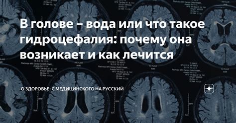 Гидроцефалия: как она влияет на полеты