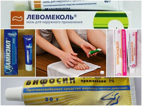 Грибок на пальце: эффективные мази и методы