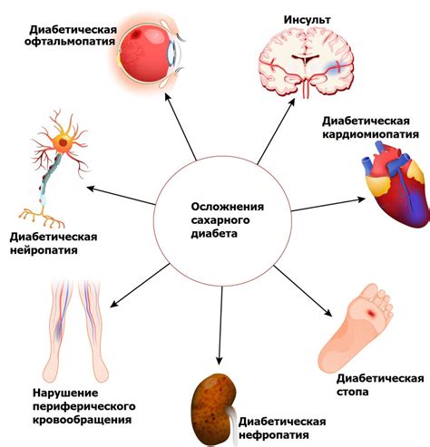 Диабет 2 и боли ног