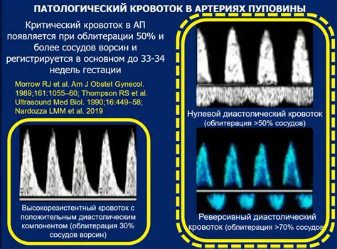 Диагностика и выявление нарушений в кровотоке