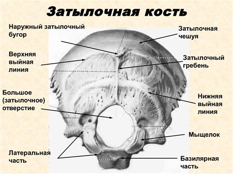 Диагностика и лечение узкой затылочной кости