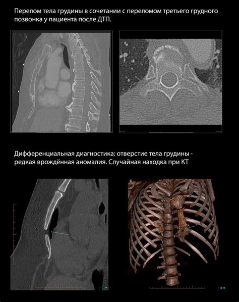 Диагностика и обследование после травмы