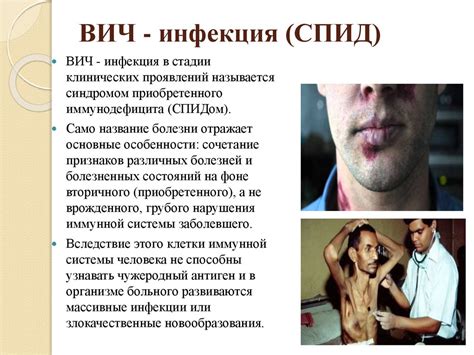 Диагностика и терапия генитального вируса человека 6-ого типа у мужчин