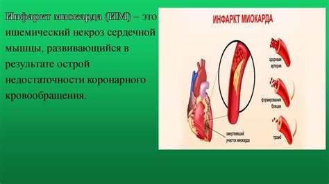 Диагностика стенокардии 3 класса