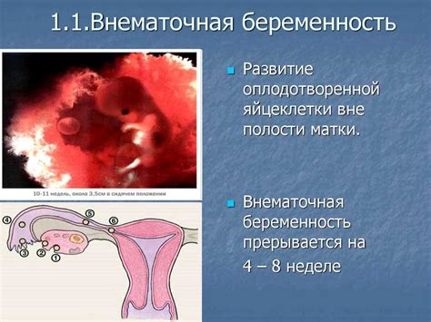 Другие признаки внематочной беременности, которые следует учитывать