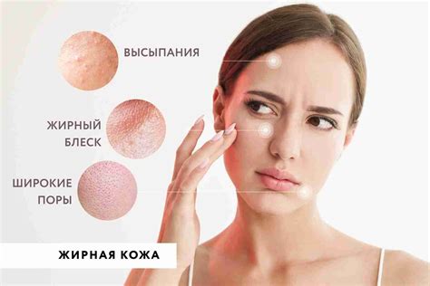 Жирная кожа: особенности и проблемы