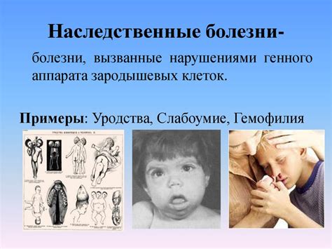 Заболевания, передаваемые голубями