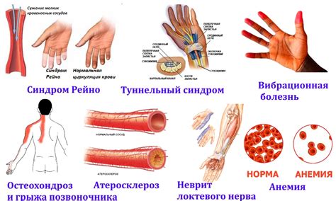 Заболевания и нарушения в работе сосудов на руках