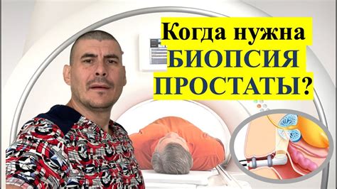 Значение соблюдения рекомендаций по питанию перед проведением процедуры биопсии костного мозга