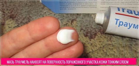 Инструкция от профессионалов: как использовать Траумель для открытых ран