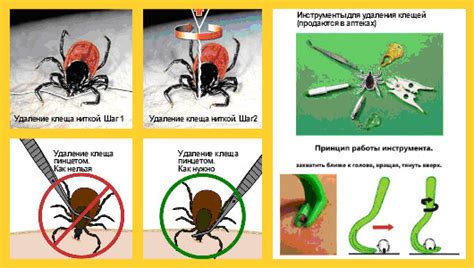 Инструкция по удалению обнаруженного клеща
