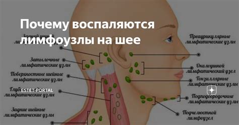 Инфекционные заболевания, связанные с увеличением лимфоузлов на шее